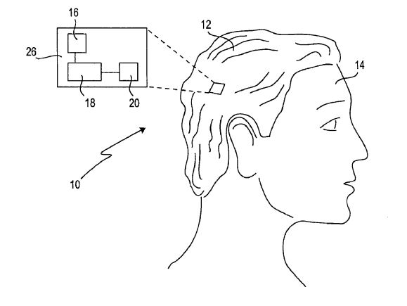 SmartWig – a peruca inteligente da Sony