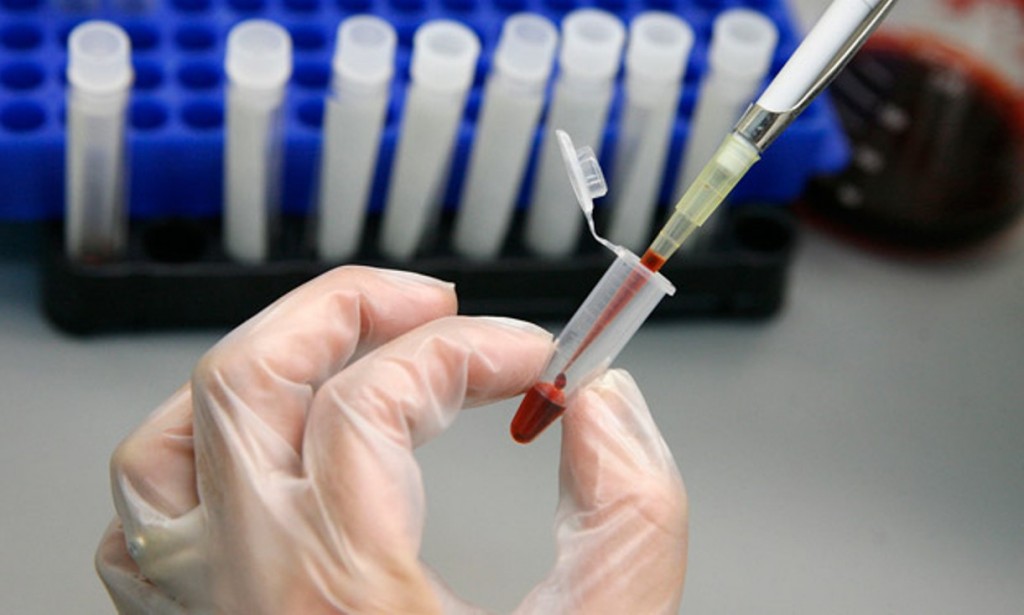 Vírus HIV – Investigadores perto de descobrir a cura
