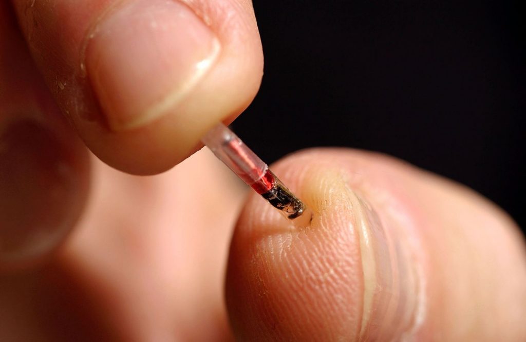 Microchip implantado na mão dos funcionários