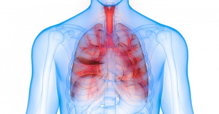 Imagem Inteligência Artificial da Google no combate ao cancro do pulmão
