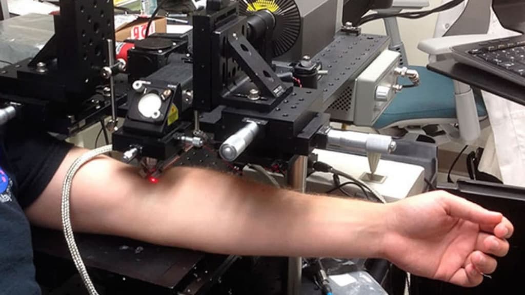 Laser destrói as células com cancro que circulam no sangue