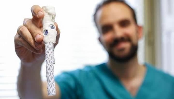 Impressão 3D de artéria do coração salva vida de paciente espanhol