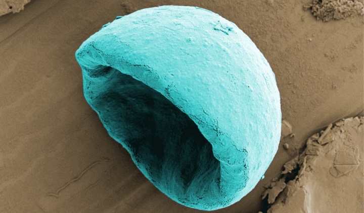 Imagem ilustrativa das bolhas minúsculas poderão fornecer fármacos para matar o cancro