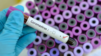 Imagem teste de sangue positivo ao vírus coronavírus