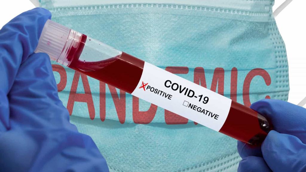 Covid-19: Por cada 100 casos em Itália, Portugal terá sete, diz estudo