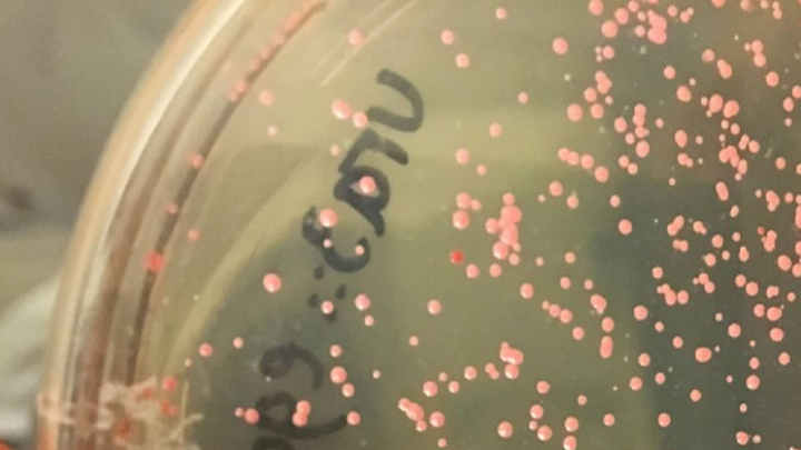 Imagem do micróbio depositário da informação da humanidade, Halobacterium salinarum