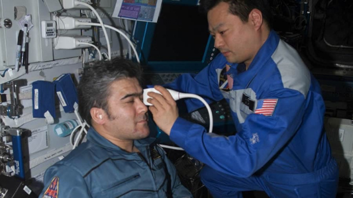 Imagem de exame ocular a astronauta da NASA na estação espacial internacioonao (ISS)