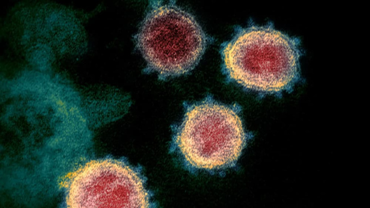 Imagem de microscópio do SARS-CoV-2, o novo coronavírus que causa a COVID-19
