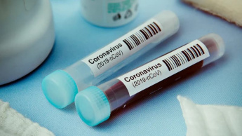 Imagem testes á COVID-19 patrocinados pela Apple