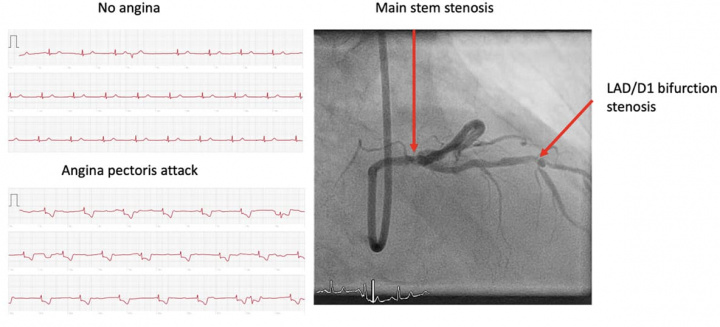 Relative ECG image showing heart problem