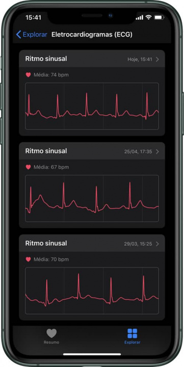 Imagem relatório ECG no iPhone app Saúde