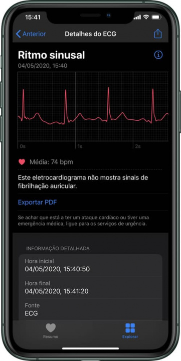 Imagem relatório ECG no iPhone app Saúde