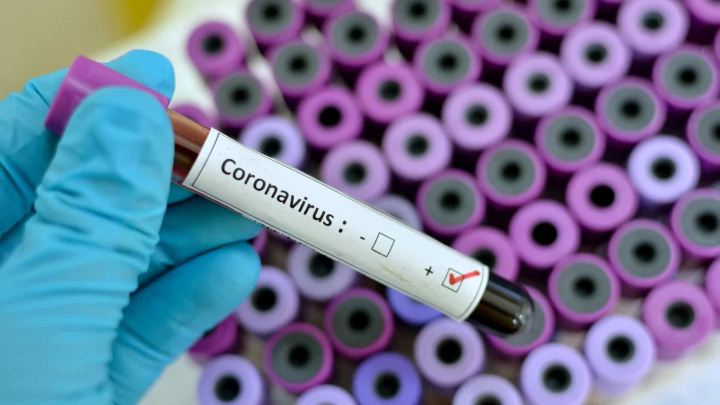 Coronavírus está a desaparecer "demasiado rápido"? Oxford diz que sim...