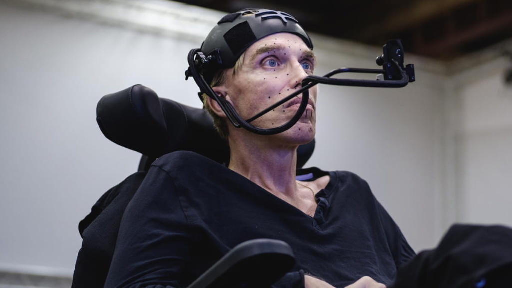 Peter Scott-Morgan: cientista poderá ser o primeiro cyborg do mundo