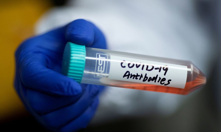 COVID-19: Anticorpos duram pelo menos 4 meses, revela estudo