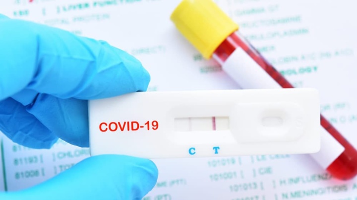 COVID-19: Quer saber se foi infetado? Inscreva-se e faça um teste gratuito