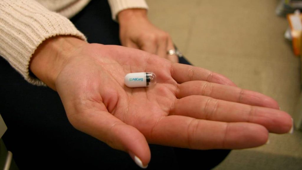 Comprimido micro-câmara é usado para detetar cancro no intestino