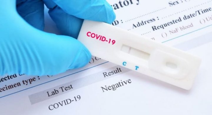 COVID-19: Testes rápidos de antigénio: Comparticipação até ao final de setembro