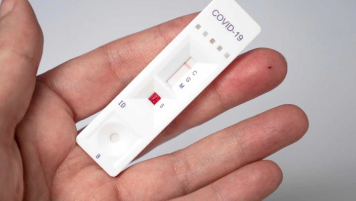 COVID-19: Saiba em que farmácias pode fazer testes rápidos gratuitos