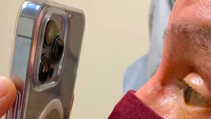 Imagem iphone 13 Pro Max a usar modo macro para monitorizar olhos dos pacientes