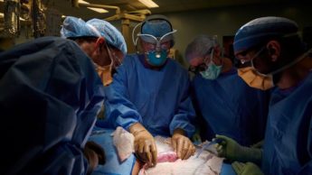 Imagens cirurgiões a fazer transplante de rim de porco para um humano