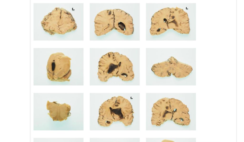 Digital Brain: Plataforma onde pode ver milhares de cérebros digitalizados