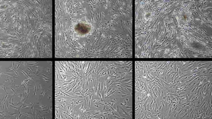 Rejuvenescimento de células humanas