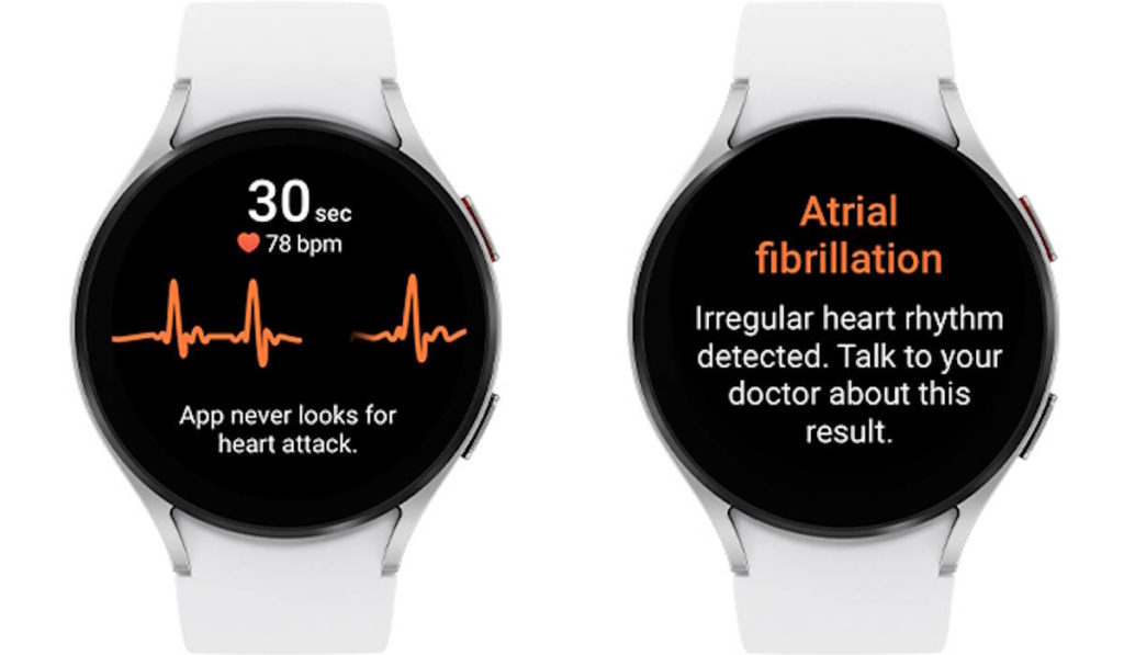 Samsung Galaxy Watch Notificação Ritmo Cardíaco Irregular eletrocardiograma