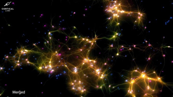 Imagem microscópica de neurónios dentro do DishBrain, com células destacadas a fluorescente. Fonte: New Atlas | Cortical Labs
