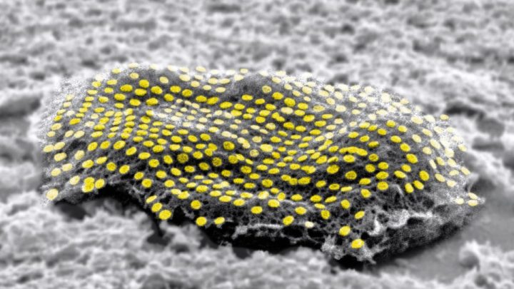 Imagem de células com filamentos de ouro