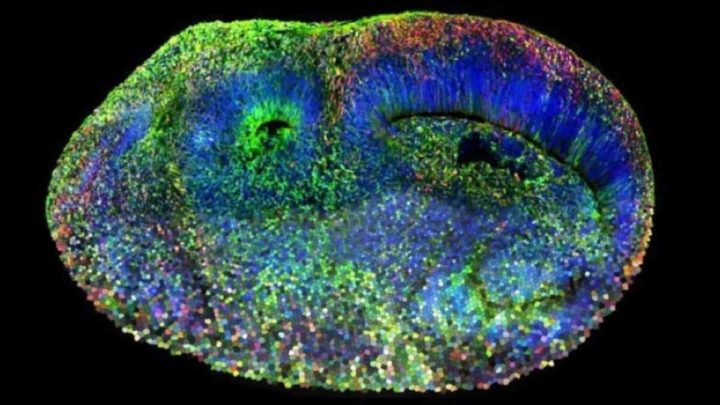 Sistema organoide do cérebro humano CHOOSE
