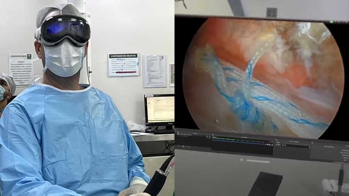 Apple Vision Pro used to assist doctor during shoulder surgery in Brazil
