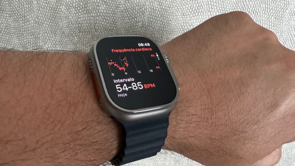 Apple Watch é importante para as pessoas submetidas a cirurgias de válvulas cardíacas