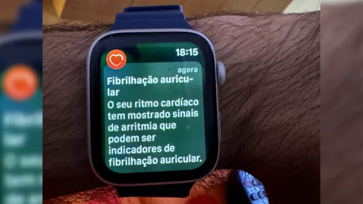 Imagem Apple Watch com deteção de fibrilhação auricular no coração