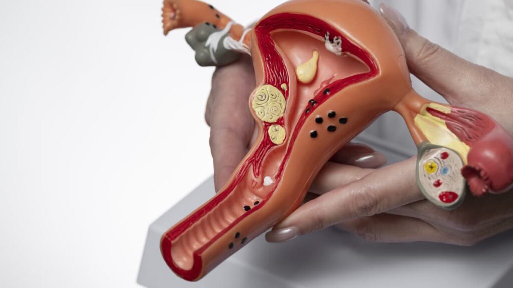 Dispositivo em forma de pretzel eliminou tumores em 82% dos pacientes