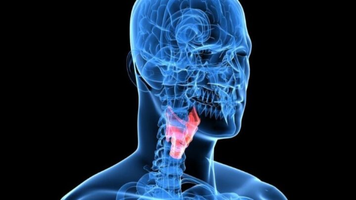 Ilustração de cancro da laringe presente