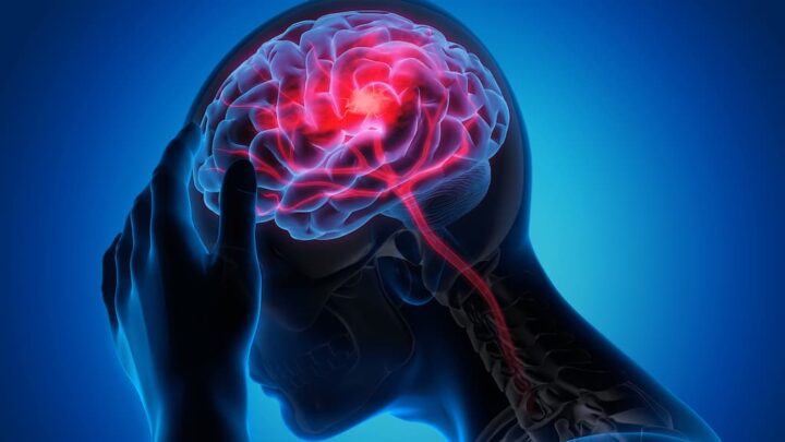 AVC: novo treino cognitivo com a ajuda da Inteligência artificial