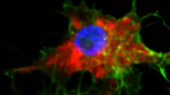 Imagem células do cancro do sangue  