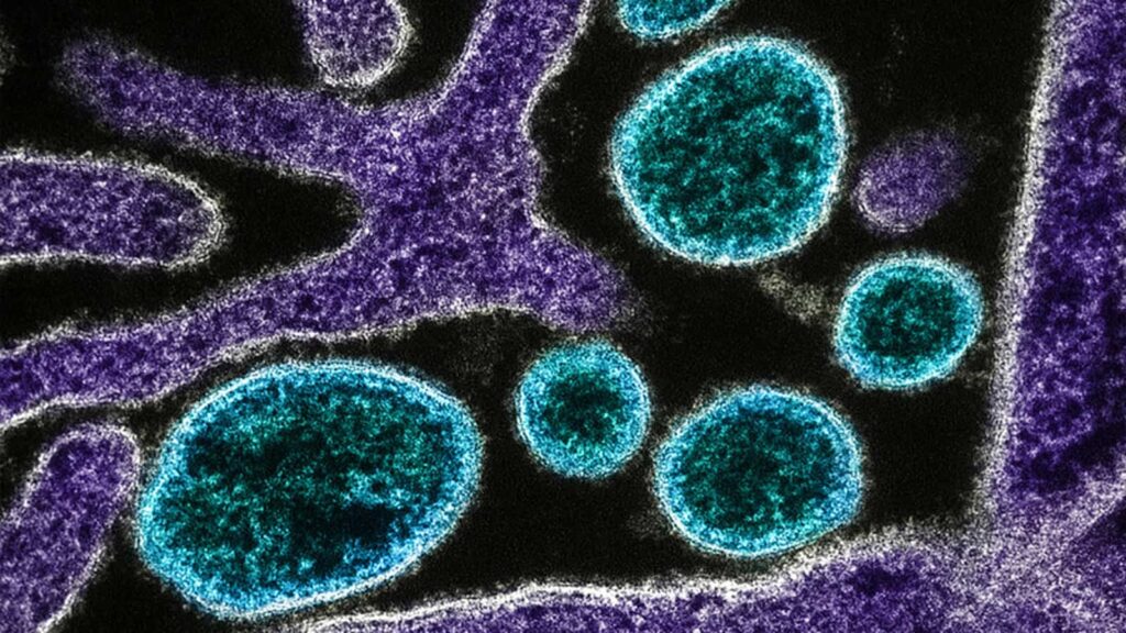 Tudo o que precisa de saber sobre o vírus Nipah