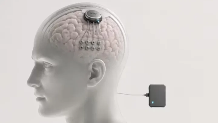 Ilustração do chip cerebral NEO, da China