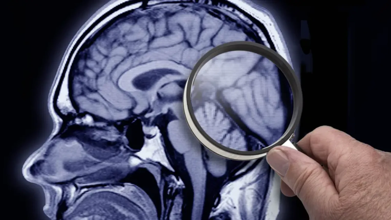 Alzheimer: Coimbra aposta numa análise ao sangue para acelerar o diagnóstico